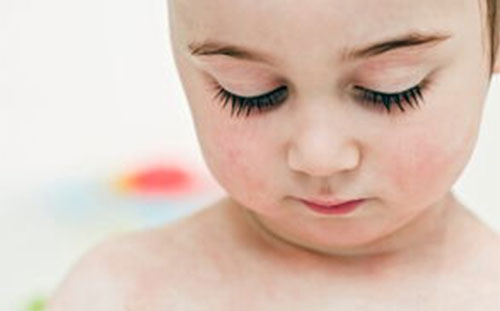 ʪ��ᴫȾ�� ʪ������Ʒ���